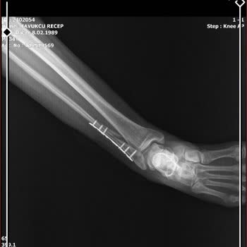 Ordu Medical Park Hastanesi Yanlış Tedavi