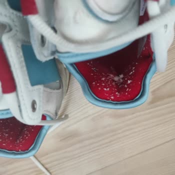 Adidas Niteball 2 Haftada Yırtıldı