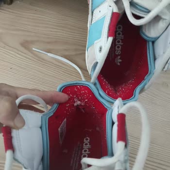 Adidas Niteball 2 Haftada Yırtıldı