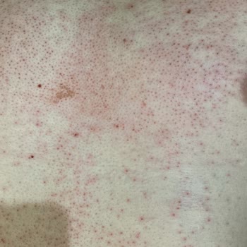 Watsons Tüy Dökücü Vücudumu Mahf Etti