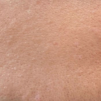 La Roche - Posay Effaclar Duo Yüz Yıkama Jeli Ve Tonic Kullanımı Sonrası Deneyimim