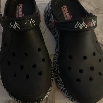 Skechers Üretimden Kaynaklanmıyorsa Sorun Kimde