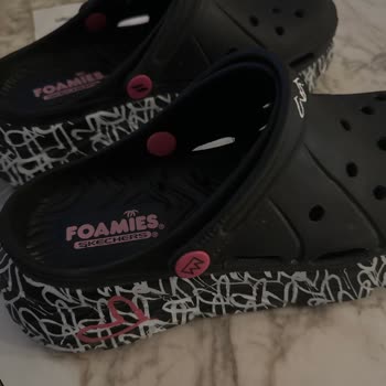 Skechers Üretimden Kaynaklanmıyorsa Sorun Kimde
