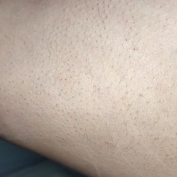 Bsl Markasından Aldığım Pantolonun Rengi Beni Maddi Zarara Uğrattı