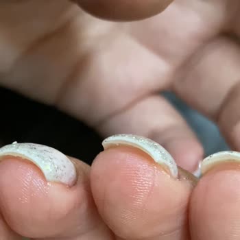Natural Nail House Naturel Nail Hause Mecidiyeköy Baştan Savma Yapılan Yamuk Tırnaklar.