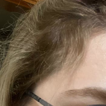 Hangar Hair Art Nişantaşı Yüksek Meblağlı İşlemine Karşın Saçlarımı Yaktı