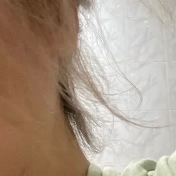 Hangar Hair Art Nişantaşı Yüksek Meblağlı İşlemine Karşın Saçlarımı Yaktı