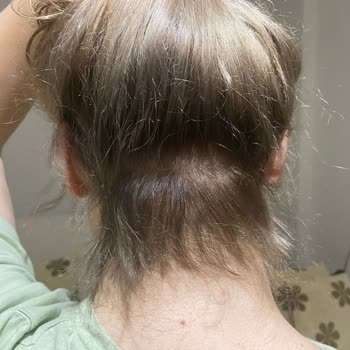 Hangar Hair Art Nişantaşı Yüksek Meblağlı İşlemine Karşın Saçlarımı Yaktı