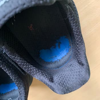 Skechers'ın İlgilenmeyen Müşteri Hizmetleri