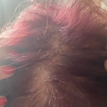 Dr. Emre Çiçek Estetik Hizmet Memnuniyetsizliği Ve Başarısız Sonuçlar