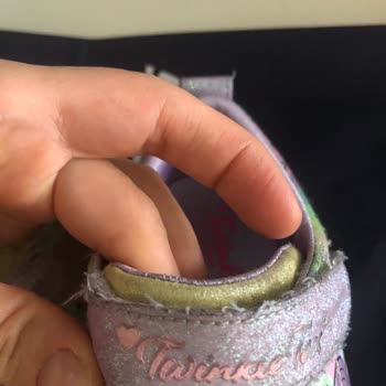 Skechers Kız Çocuk Spor Ayakkabı Sorunu