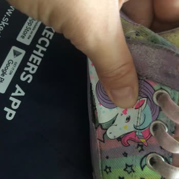 Skechers Kız Çocuk Spor Ayakkabı Sorunu