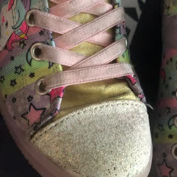 Skechers Kız Çocuk Spor Ayakkabı Sorunu