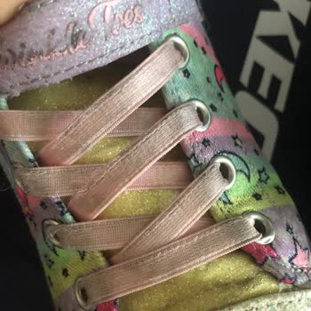 Skechers Kız Çocuk Spor Ayakkabı Sorunu