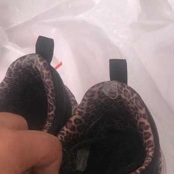 Skechers Garantili Ayakkabıların Arkasında Durmuyor