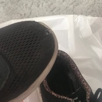 Skechers Garantili Ayakkabıların Arkasında Durmuyor