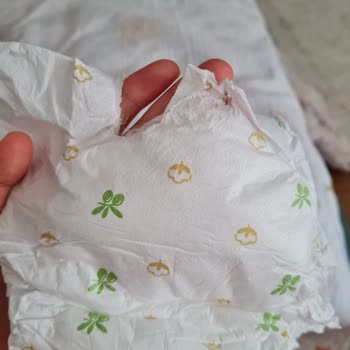 Baby Turco Bebek Bezinin Arka Kısmı Yırtık