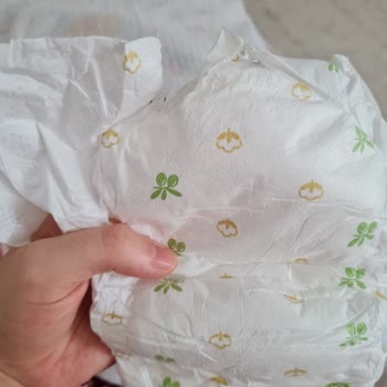 Baby Turco Bebek Bezinin Arka Kısmı Yırtık