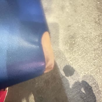 Anadolu Jet Valizimin Tekerleğini Kırdı Ve Valizim Parçalanmış