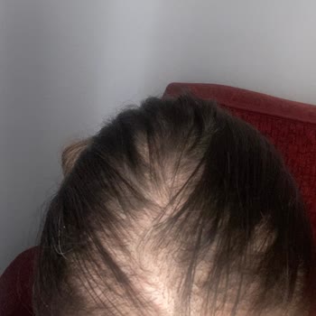 S Clinic Diyarbakır Saç, Paranızı Sokağa Atmayın.