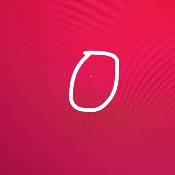 Samsung Yeni TV Ölü Piksel