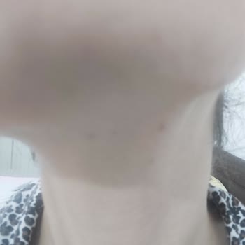 Licape Tonik Ve Çay Ağacı Yıkama Jeli