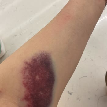 Dr. Suat Seren Göğüs Hastalıkları Hastanesi Doktor Ve Hemşire