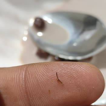 Kellogg's Coco Pops İçinden Böcek Bacağı Çıktı