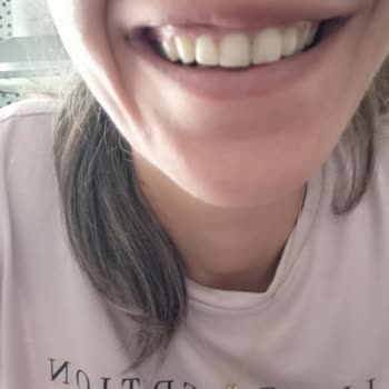 Ortoperio Yanlış Tel Tedavisi