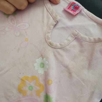 Vanish Kosla Aldım, Lekeyi Çıkartmıyor!