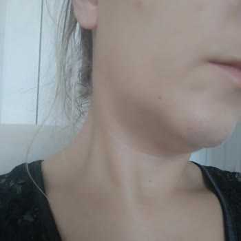 New Well Serum Fondöten Cildimi Bozdu