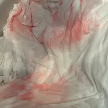 Domestos Beyaz Elbisemi Pespembe Yaptı!