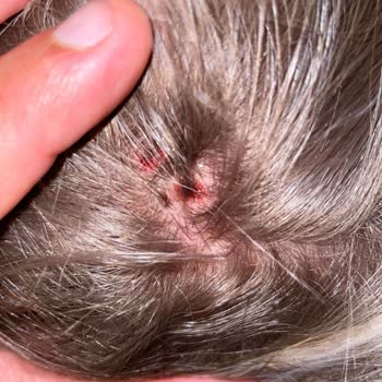 San Kuaför Kafamın Derisini Yaktı Müşterilere Hiç Saygı Duymuyorlar