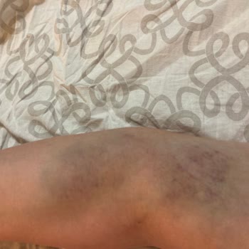 Medicana Hospitals Damar Yolu Açamama!