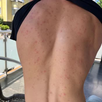 Watsons Weet Men Tüy Dökücü Kremden Şikayetçiyim