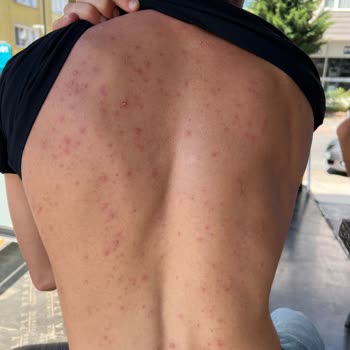 Watsons Weet Men Tüy Dökücü Kremden Şikayetçiyim