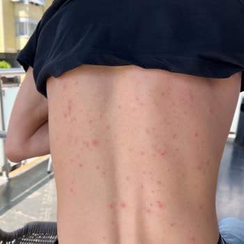 Watsons Weet Men Tüy Dökücü Kremden Şikayetçiyim