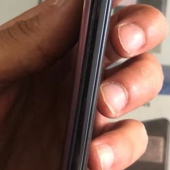 Xiaomi Yetkili Servis (Evofone) Servis Özensizliği Ve Kalitesizliği
