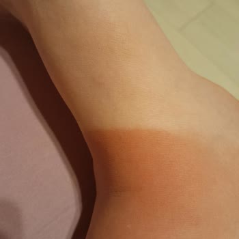 Yaktın Bizi Cire Aseptine Güneş Kremi