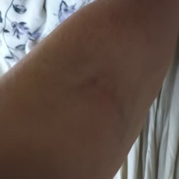 Raid Elektro Likit Hiçbir İşe Yaramıyor