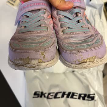 Skechers Ayakkabı Kalitesizliği Ve Marka Ürününün Arkasında Durmadı