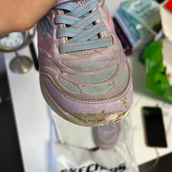 Skechers Ayakkabı Kalitesizliği Ve Marka Ürününün Arkasında Durmadı