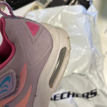 Skechers Ayakkabı Kalitesizliği Ve Marka Ürününün Arkasında Durmadı