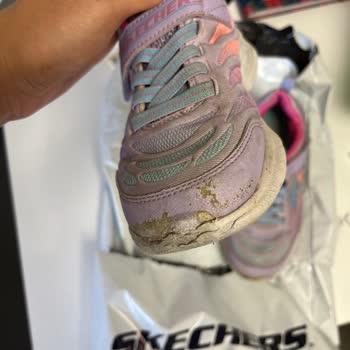 Skechers Ayakkabı Kalitesizliği Ve Marka Ürününün Arkasında Durmadı