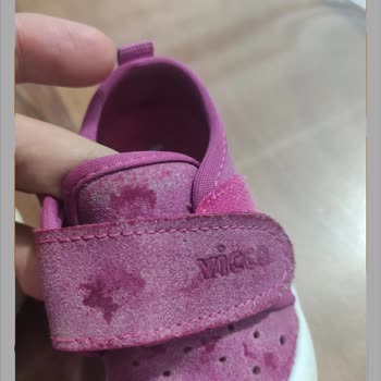 Vicco Kullanım Sonrası Hasar