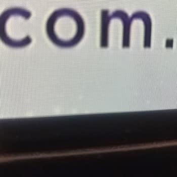 LG Oled Televizyonda Ekranda Ölü Piksel Ve Lekelenmeler Oluştu