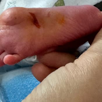 Prof. Dr. Cemil Taşçıoğlu Şehir Hastanesi Sezaryen Ameliyatında Bebeğimin Ayak Tabanını Kestiler