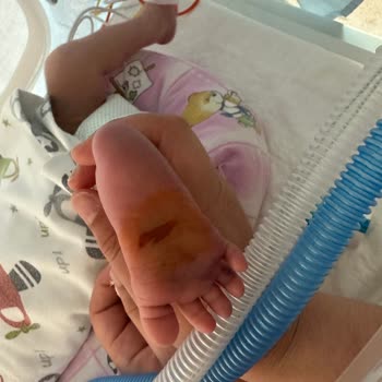 Prof. Dr. Cemil Taşçıoğlu Şehir Hastanesi Sezaryen Ameliyatında Bebeğimin Ayak Tabanını Kestiler