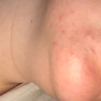 Garnier Hyaluronik Aloe Jel