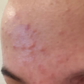 Garnier Hyaluronik Aloe Jel